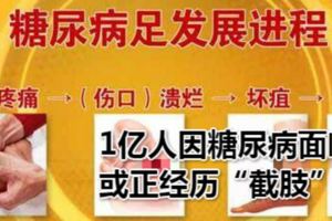 1億人因糖尿病面臨或正經歷「截肢」，你可了解糖尿病足的嚴重性