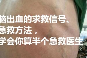 心梗、腦梗、腦出血的求救信號、急救方法，學會你算半個急救醫生