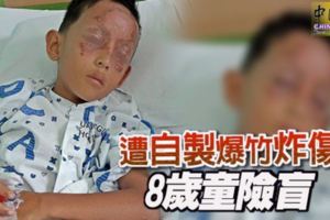 8歲男童點燃自製爆竹，結果險些失明！