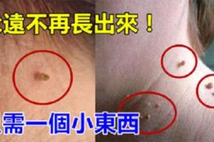 脖子上突然長了「肉粒」，這個到底是什麼東西？只需「1個小東西」，就能讓「肉粒」徹底脫落！