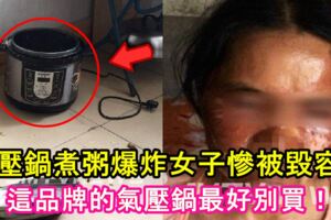 氣壓鍋煮粥爆炸！女子慘被毀容！這品牌的氣壓鍋最好別買！