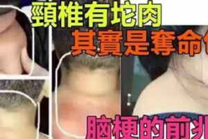 「頸椎有坨肉號稱富貴包」其實是奪命包～是腦梗的前兆，教你3招解決它！