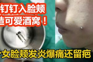 少女想變美要可愛酒窩竟鋼釘入臉頰發炎爆痛還留疤