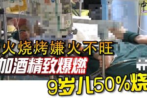 炭火燒烤嫌火不旺母加酒精緻爆燃9歲兒50%燒傷