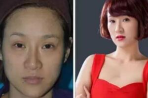 生了孩子後，有的產婦老了30歲，有的產婦卻越來越年輕，因為？