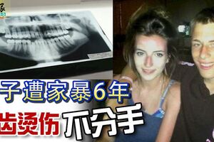 男子遭女友家暴6年，斷齒燙傷不分手，還打算將他的經歷拍攝成紀錄片