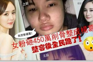 我想變楊冪！女粉砸450萬削骨整成楊冪！整容後全民跪了W0W～