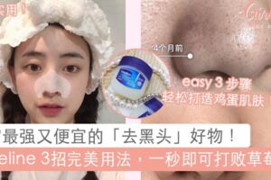 向頑固「黑頭」說再見！Vaseline3招完美formula用法，一秒既能去除千年老「黑頭」！?