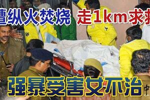 遭縱火焚燒走1km求救強暴受害女不治