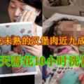 【內附視頻】4歲女童吃未熟的漢堡肉近九成腎髒損傷每天需花10小時洗腎