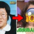 她從小被恥笑「蛞蝓腥臭女」決定砸錢整形！8個月後「術後模樣」卻讓網友痛罵：醫生整人！