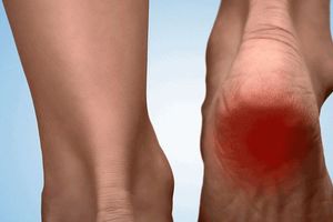 腳後跟疼怎麼回事？5 個方法緩解疼痛