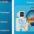 超聲內鏡，給你一雙探查胃腸道的「透視眼」