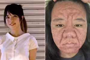 28歲女因懷孕「樣貌大變」!生產完近況曝 28歲女因懷孕「樣貌大變」!生產完近況曝