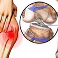 上了年紀，關節炎、膝蓋痛？「三個動作」讓膝蓋多用30年，膝蓋越年輕！