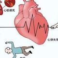 得了冠心病，該怎麼辦呢？一文教你什麼是冠心病，該怎麼辦
