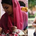 印度2歲女孩罹怪病，天天脫皮甚至長出「蜥蜴鱗片」，母親痛心坦承：「有時希望她死掉！」 