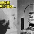 13張100年前 治療精神病患者的超殘忍治療方法 看完後沒精神病都變精神病了吧...！