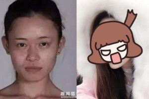 她就是「花百萬也要整成Angelababy」的強國女人，超扯的整形日記一曝光就讓大家看傻了眼！