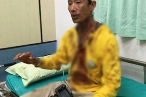 阻潛水客非法打魚！澎湖保育志工遭「手電筒5下爆頭」　衣服全染紅