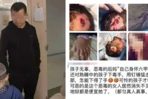 （氣憤！5歲男童熟睡中竟被爸爸懷孕女友毒打，鎚子猛擊，傷口深見頭骨！）