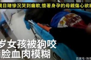 9歲女童被狗咬臉，送醫院時已休克,父親目睹慘況哭到癱軟,懷著身孕的母親傷心欲絕