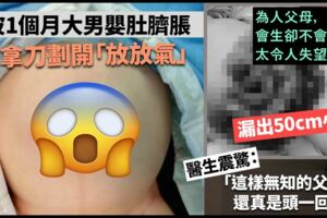 寶寶肚子鼓鼓的，　父親竟用刀片劃開肚臍「放放氣」！　馬上掉出半米長小腸