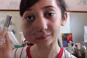 她6歲時發現罹患罕見病症導致「半邊臉畸形」，結果不能去上學的她竟然都在家做這些…太強大了！