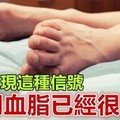 腿上出現這種信號，說明血脂已經很高了，別太晚知道了... 