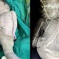 心疼!出生沒性器…嬰兒雙腳相連像「美人魚」　活15分鐘就夭折!