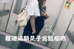 懷孕被阿婆逼讓博愛座　孕婦怒：難道這顆是子宮肌瘤？