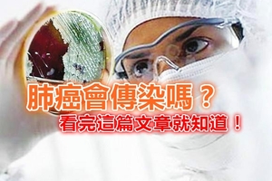 肺癌會傳染嗎？看完這篇文章就知道！