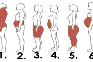 這6種人，大家都以為是「一般肥胖」但其實90%的人都搞錯了！他們找了「4000個胖子」做研究！沒想到竟發現...