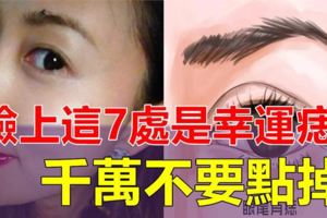 女人臉上這7處長痣是幸運痣，千萬不要點掉