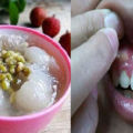 牙痛起來要人命！備一碗這種湯，即5分鐘得救！七種解決牙疼的方法，趕緊收藏吧！