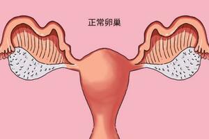 人年輕，卵巢卻老了，為什麼會卵巢早衰？還能懷孕嗎？