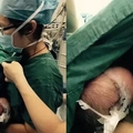 一個多月大的寶寶在手術室哭鬧不停！護士將嬰兒抱起來後竟然掀起衣服...接下來發生的事感動了全世界啊！