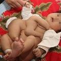 孩子一出生就抱著一具“屍體”把醫生給嚇壞了！檢查後父母都哭了