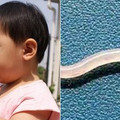 5歲女童的肛門竟排出60餘條小蟲，嚇壞了家人，原來是這樣！