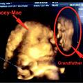 孕婦媽媽明明隻懷一胎，但這張4D超音波靈異照片卻讓她嚇壞了！