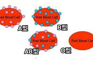 原來得病跟「血型」也有關！什麼血型要注意什麼健康隱患，非常重要！千萬要注意！