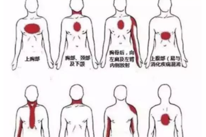 別總說心梗毫無征兆，心髒發出的求救信號你在意了嗎？