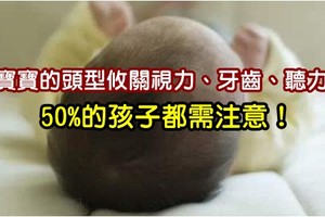 寶寶的頭型攸關視力、牙齒、聽力～50%的孩子都需注意！