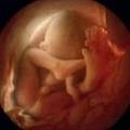 10年拍攝精子進入女人身體形成胎兒的神奇照片!!