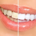 美白牙齒讓你擁有迷人微笑！牙齒變黃的原因可能有「這幾種」！