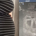 她產檢時才發現懷的不止一個，「寶寶數量」多到真的超出乎預料...