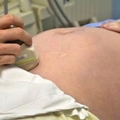 她墮胎完月經還是沒來，後來肚子竟越來越大！自行驗孕15次都顯示有喜!?