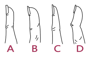 測試：你的手指最接近哪個類型？一眼看出你一生有多大福氣！