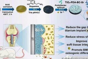 《Carbohyd. Polym.》：功能化塗層有效改善鈦種植體的骨整合能力