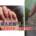 折磨人的腳氣，用「它」連泡10天，終於治好了！